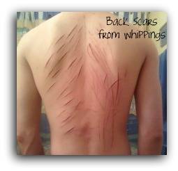 Cotton's Back Scars2.jpg