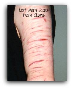 Cotton's Scars on Left Arm2.jpg