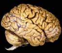 humanBrain.jpg
