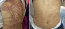 Hwyn Scars.jpg