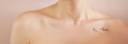 shiress_scars1.jpg